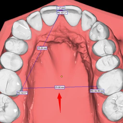Digitale opstelling — uitgangssituatie: breedte 29,88 mm, spleet 1,17 mm.